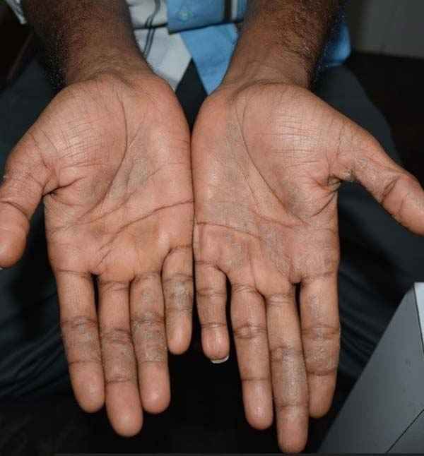 Skin Clinic In Madurai Adityan Skin Clinic In Madurai