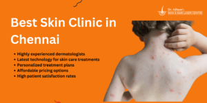 Best Skin Clinic in Chennai