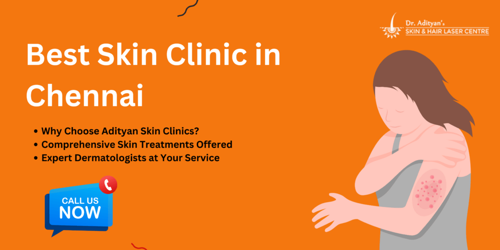 Best Skin Clinic in Chennai