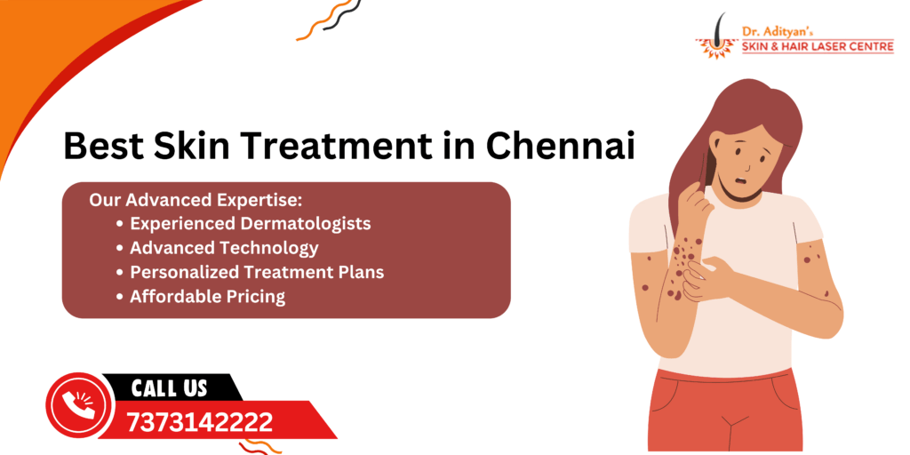 Skin Treatment in Chennai
