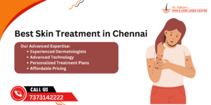 Read more about the article Best Skin Treatment in Chennai – Advanced Solutions at Adityan Skin Clinic