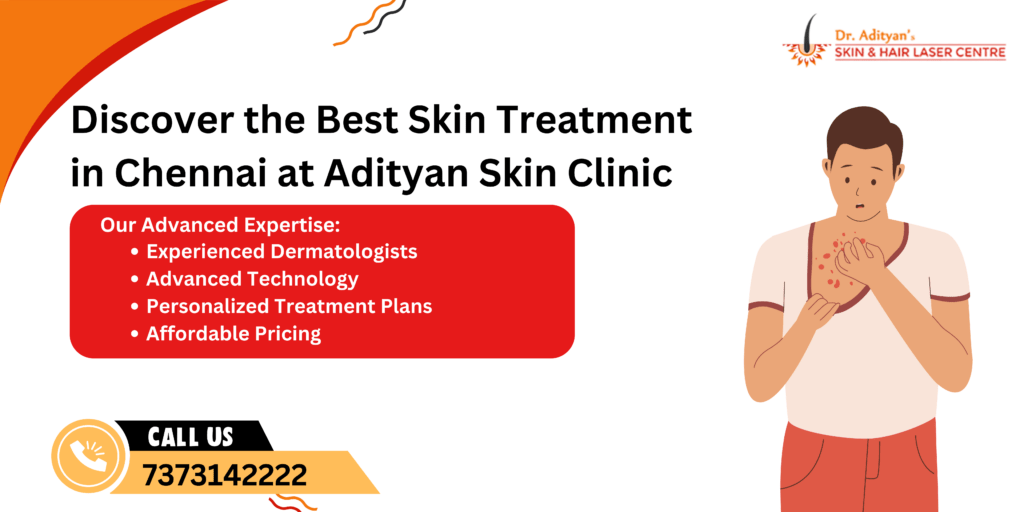 best skin treatment in Chennai