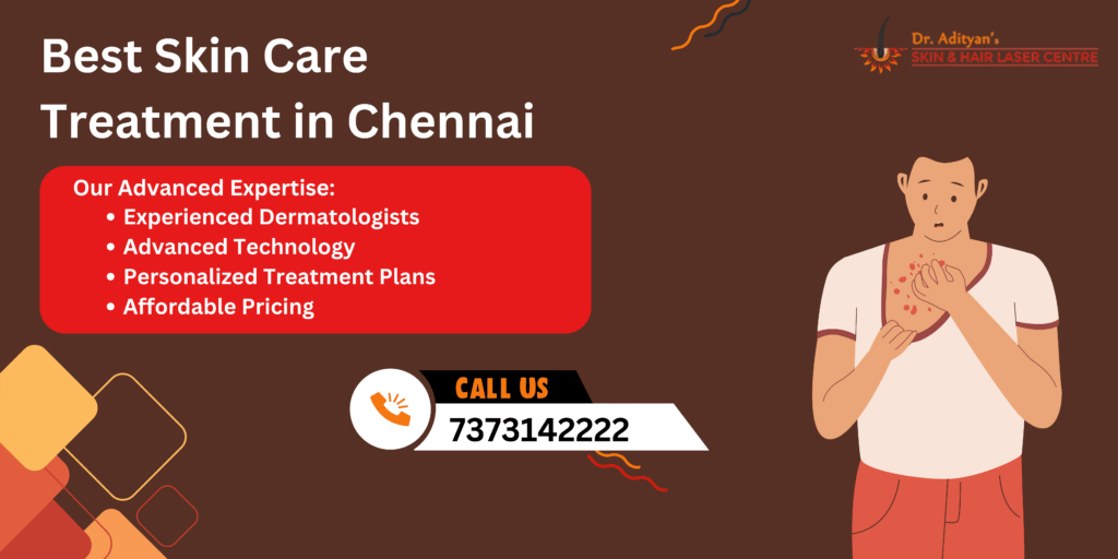 Best Skin Care Treatment in Chennai