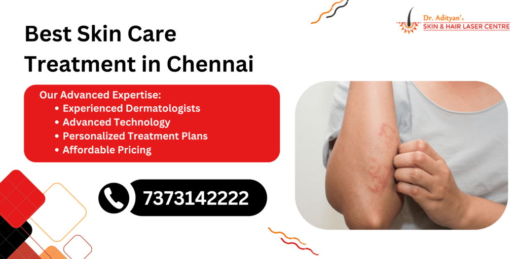 Best Skin Care Treatment in Chennai