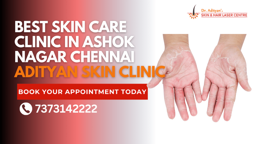 Best Skin Care Clinic in Ashok Nagar Chennai