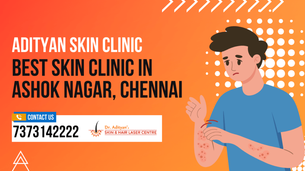 Best Skin Clinic in Ashok Nagar Chennai