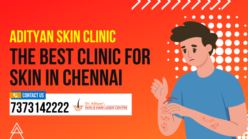 The Best Clinic for Skin in Chennai
