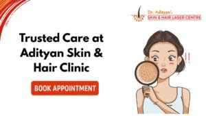Read more about the article Best Skin Clinic Near Saidapet – Trusted Care at Adityan Skin & Hair Clinic