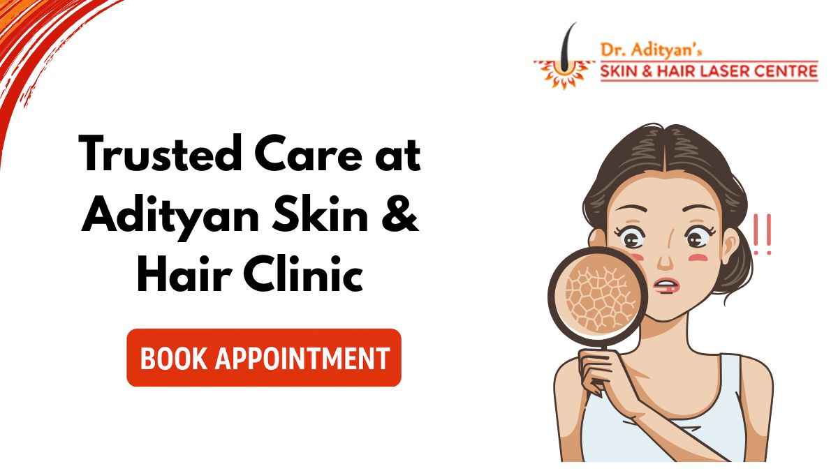 You are currently viewing Best Skin Clinic Near Saidapet – Trusted Care at Adityan Skin & Hair Clinic