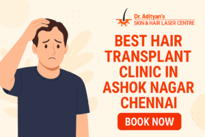 Read more about the article Best Hair Transplant Clinic in Ashok Nagar Chennai: Adityan Skin Clinics