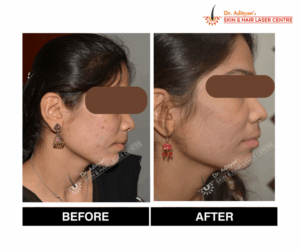 Read more about the article Find the Best Dermatologist Near Ashok Nagar – Skin Confidence Starts Here