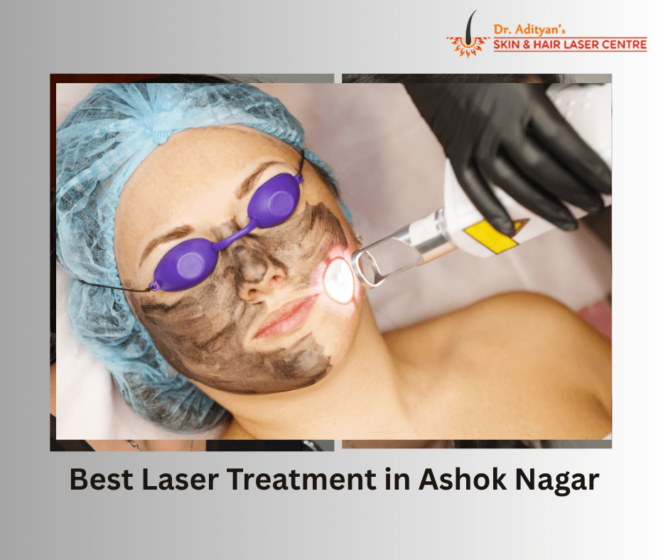 Read more about the article Discover the Best Laser Treatment in Ashok Nagar at Adityan Skin & Hair Clinic