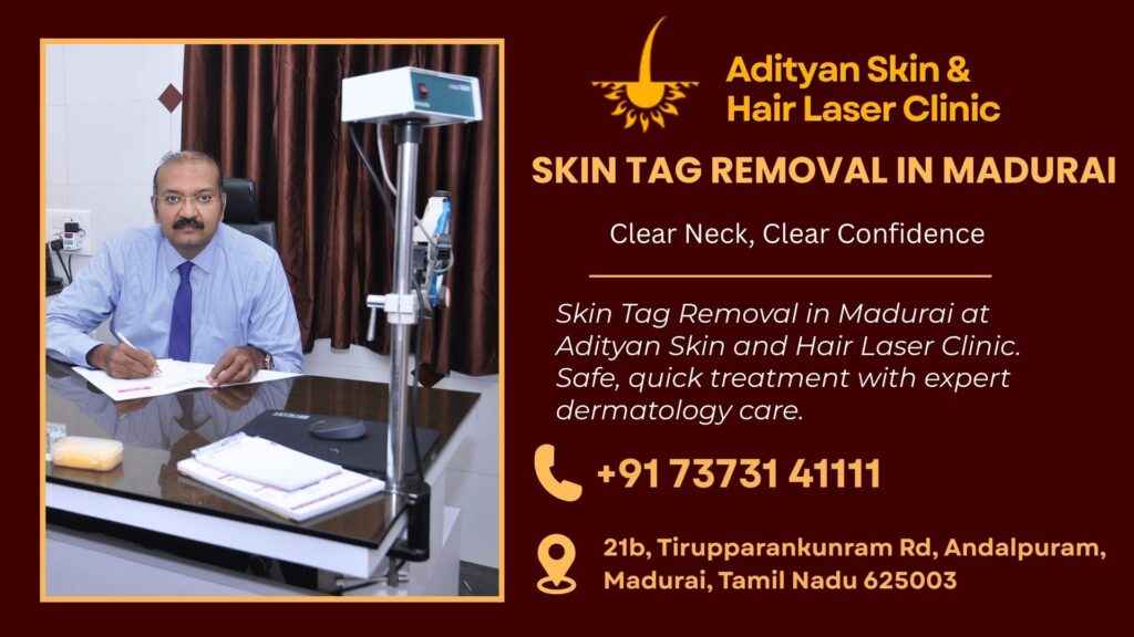 Skin Tag Removal in Madurai at Adityan Skin and Hair Laser Clinic. Safe, quick treatment with expert dermatology care.