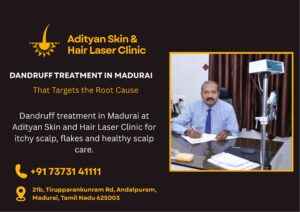 Read more about the article Dandruff Treatment in Madurai That Targets the Root Cause