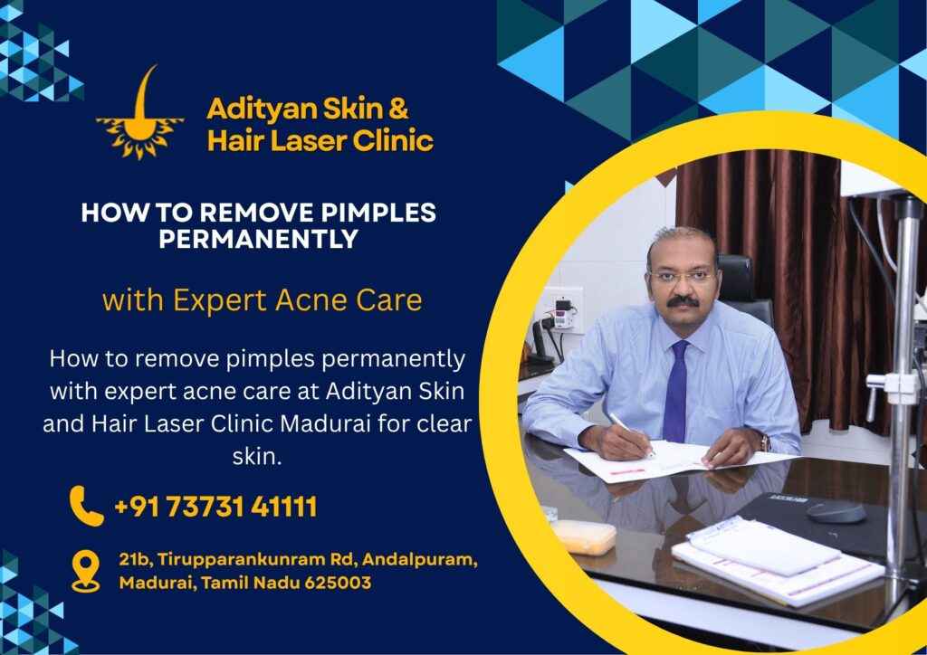 How to remove pimples permanently with expert acne care at Adityan Skin and Hair Laser Clinic Madurai for clear skin.
