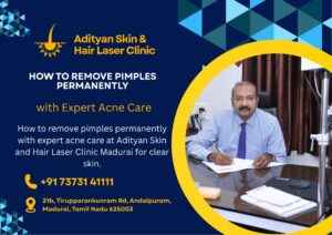 Read more about the article How to Remove Pimples Permanently with Expert Acne Care