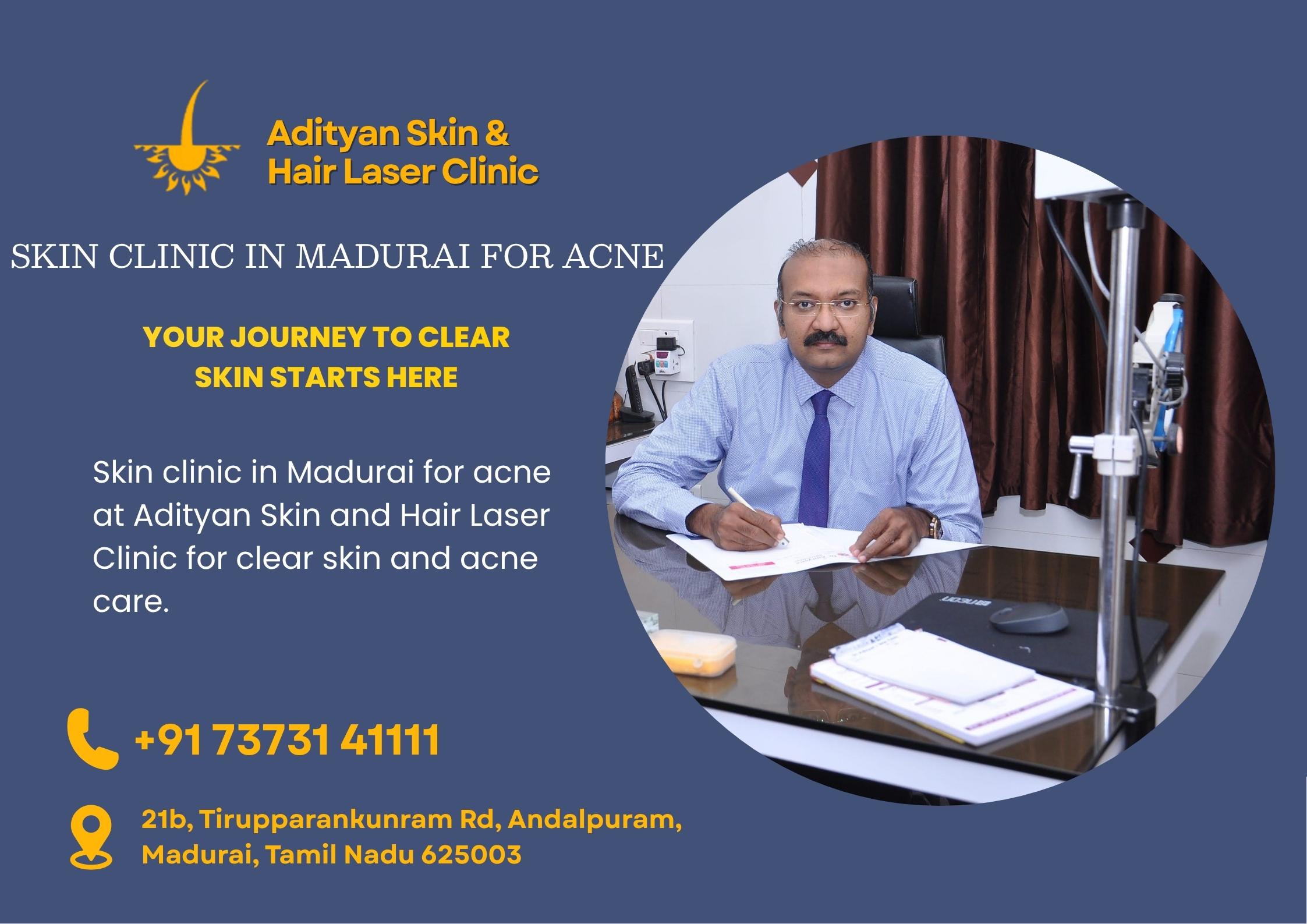 skin clinic in Madurai for acne